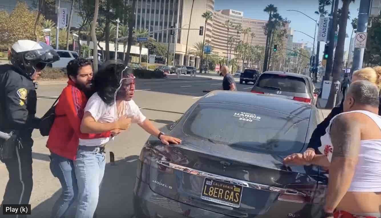 Things Get Bloody Outside Democratic Event As Trump Supporter Fights ...