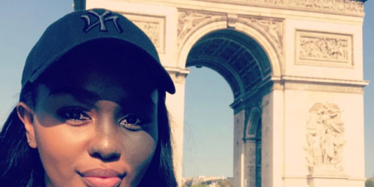 How I Learned To Love My Birthmark xoNecole Women's