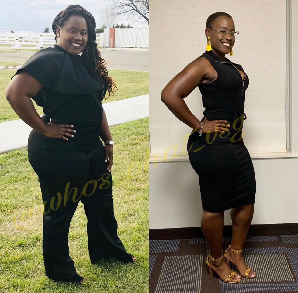 Why I Decided To Have Weight-Loss Surgery - xoNecole: Lifestyle ...