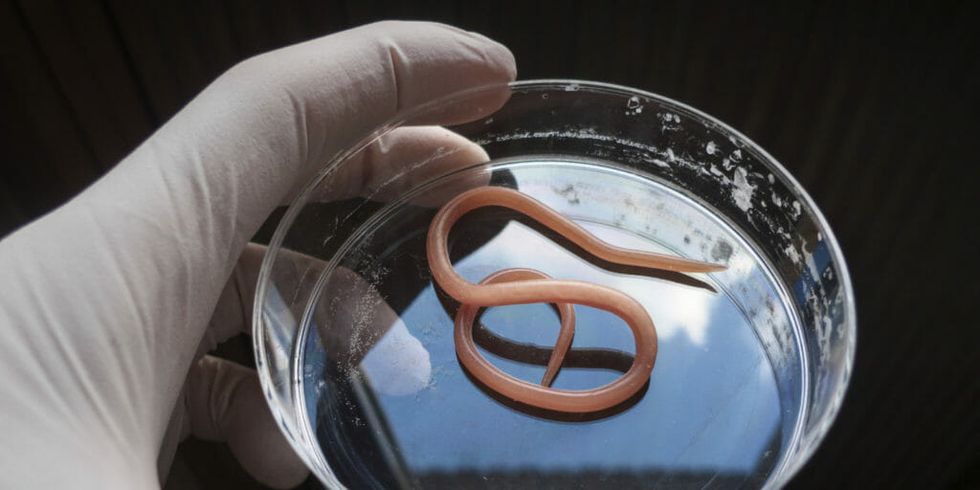 Move Over, Fecal Transplants. Here Come the Worms.