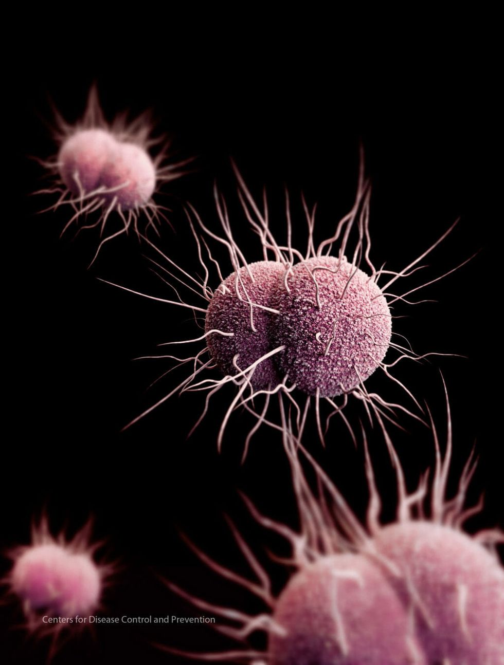 The Latest SuperResistant Bacteria is an STD Second Nexus