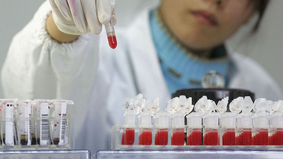 British Scientists May Have Just Cured The First Person Ever of HIV
