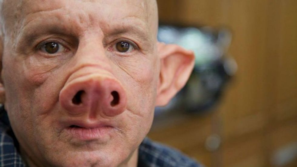 Could a Human-Pig Hybrid Be in our Future?