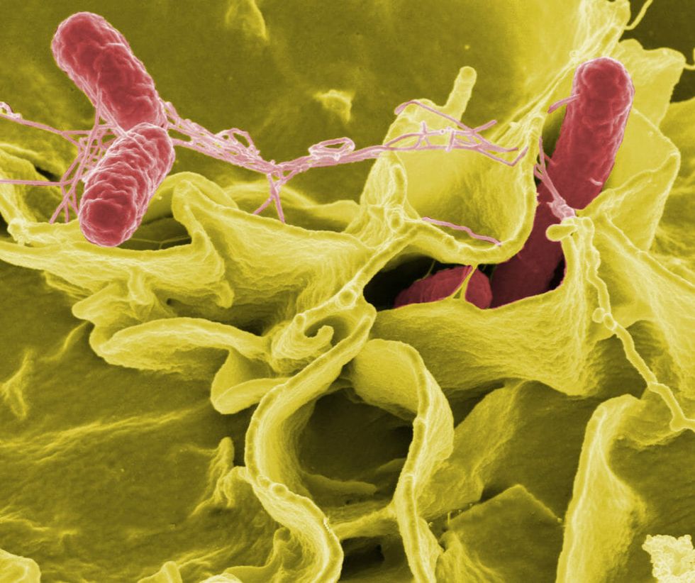 Who Knew Salmonella Might Be the Key to Fighting Cancer?