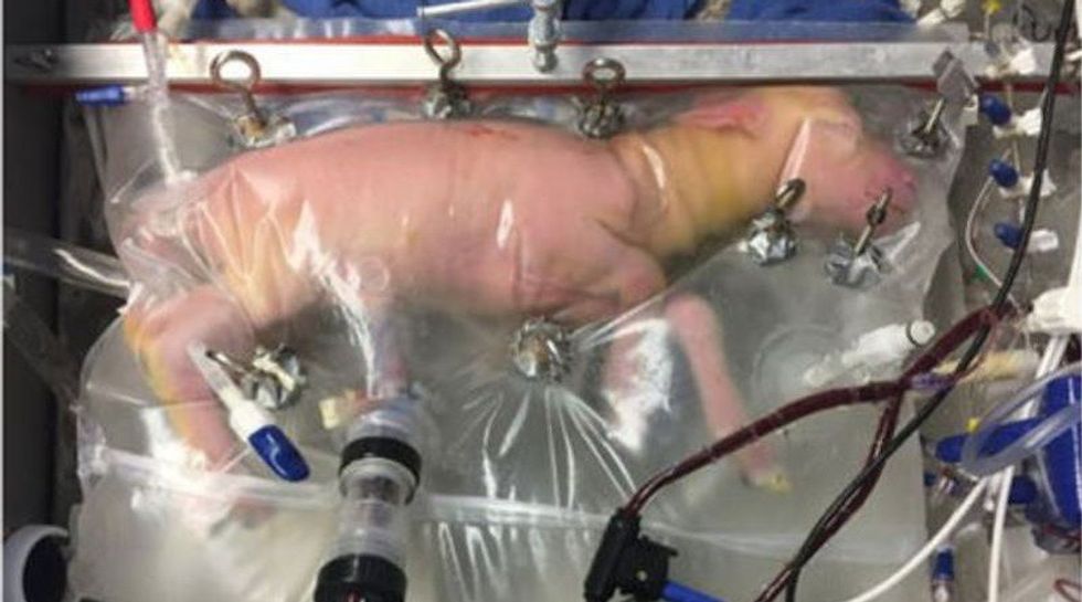 Lamb Fetuses Grown in Plastic BioBag, Humans May Be Next