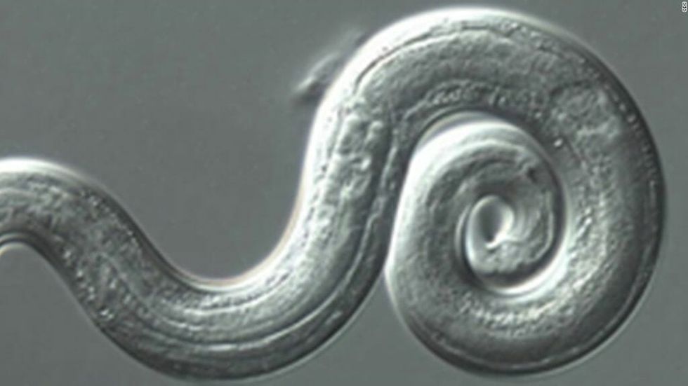 There's a parasite called rat lungworm and these newlyweds just got it