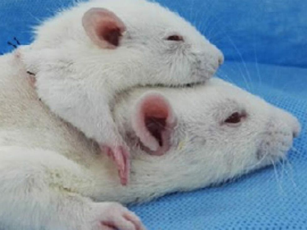 Scientists Transplanted A Rat's Head Onto Another Rat. Are Humans Next?