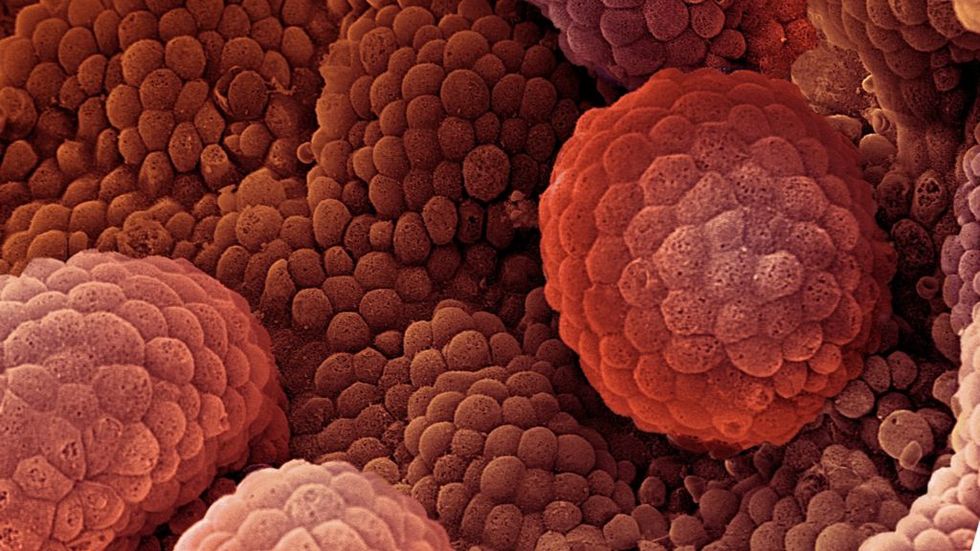 A Recent Breakthrough Might Be The Key to Slowing Cancer Growth