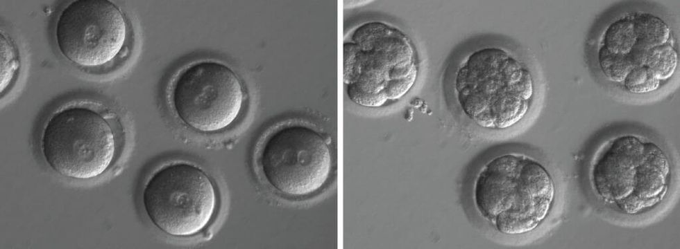 Scientists Have Modified a Human Embryo to Eliminate a Genetic Disease