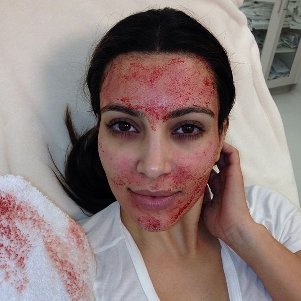 Kim Kardashian Is Suing the Vampire Facials Inventor