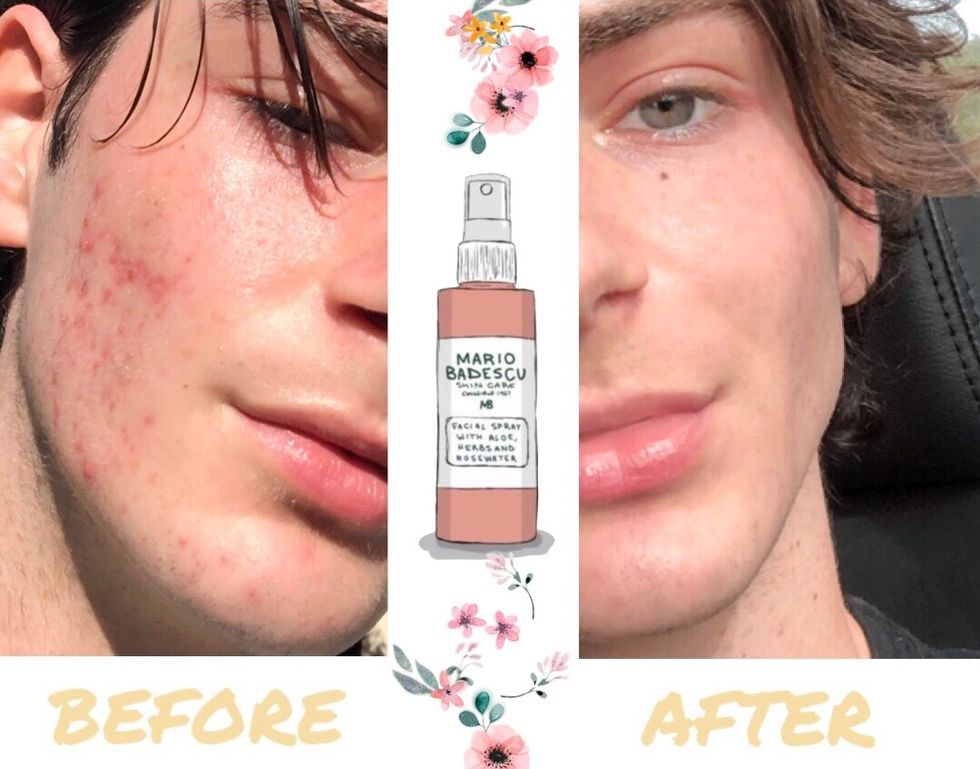It's Time To Start Caring About Your Skincare