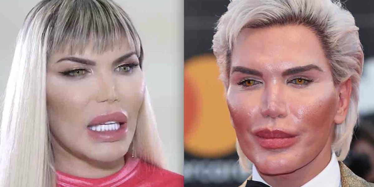 'Human Ken doll' — who spent more than $600,000 on over 70 surgeries to ...