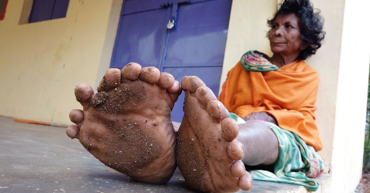 Woman With Record-Breaking 31 Fingers And Toes Says She's Been Branded A 'Witch' By Neighbors