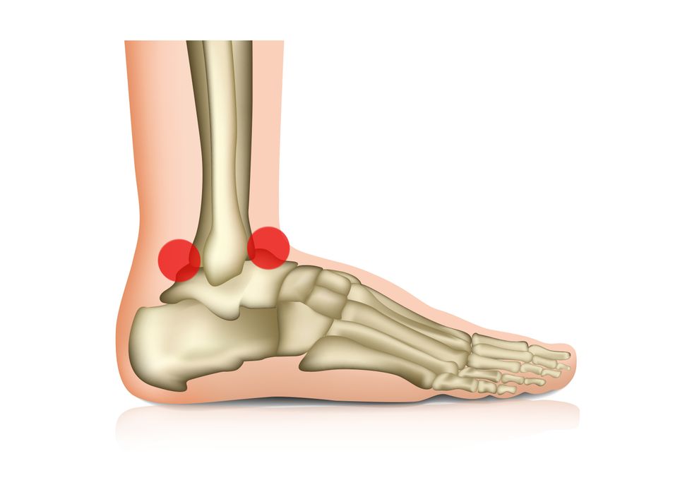 Digital drawing of a foot's bones, with red dots on the front and back of the ankle bone.