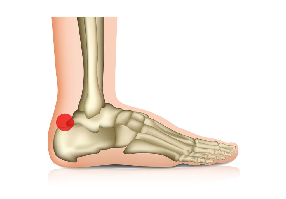 Digital drawing of a foot's bones, with a red dot on the back of the heel.