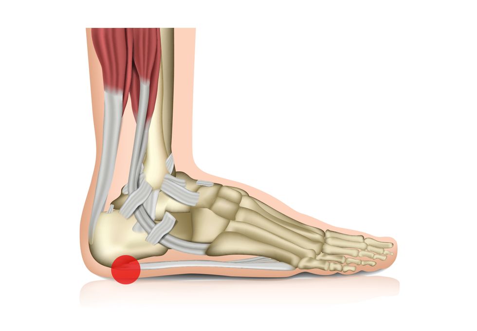 Digital drawing of a foot's bones and muscles, with a red dot under the heel.
