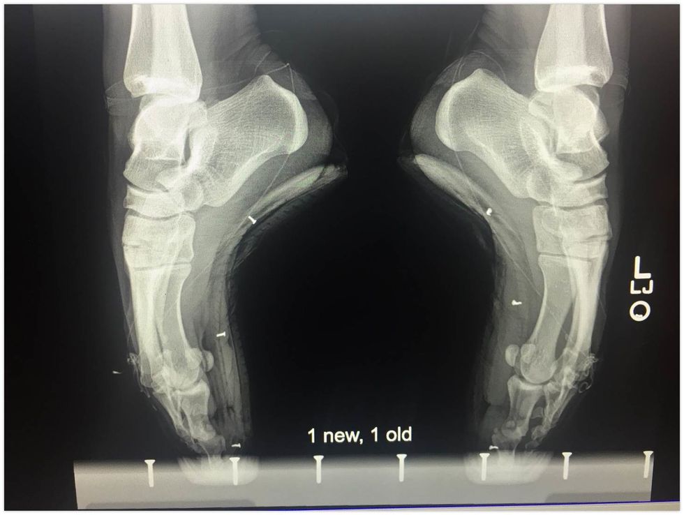 How does a dead pointe shoe cause injury? Dance Magazine