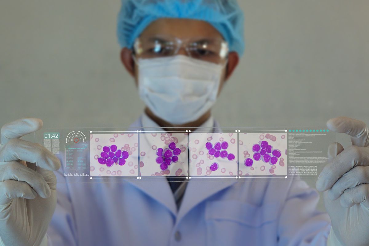 Il cancro oggi si combatte gene per gene