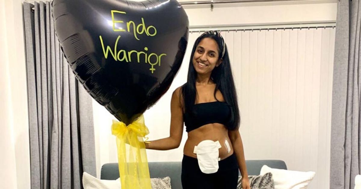 Young Woman Left With Ileostomy Bag After Battle With Endometriosis Finds Her Confidence After Showing It Off Online