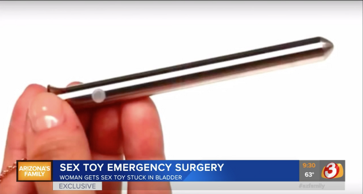 Woman Requires Emergency Surgery After Vibrator Somehow Ends Up In Her Bladder—Still Vibrating