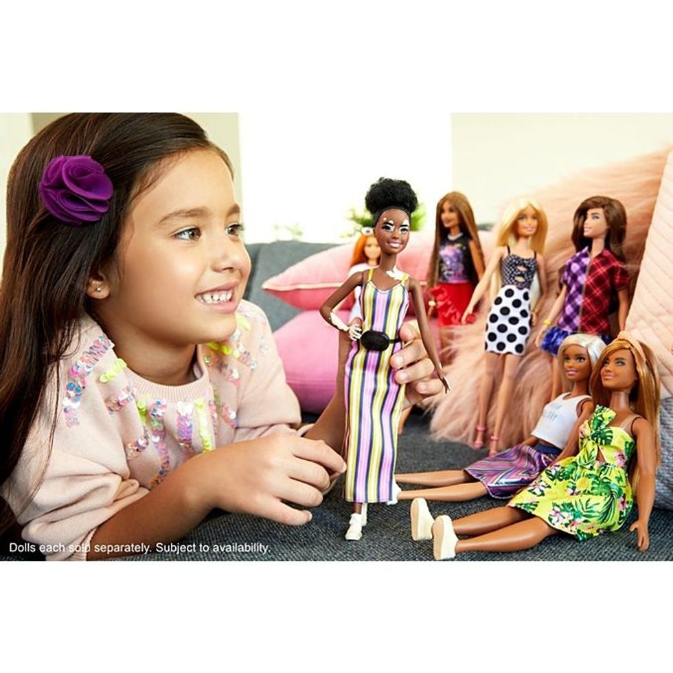 Barbie debuts dolls with vitiligo, no hair, prosthetic leg - It's a ...