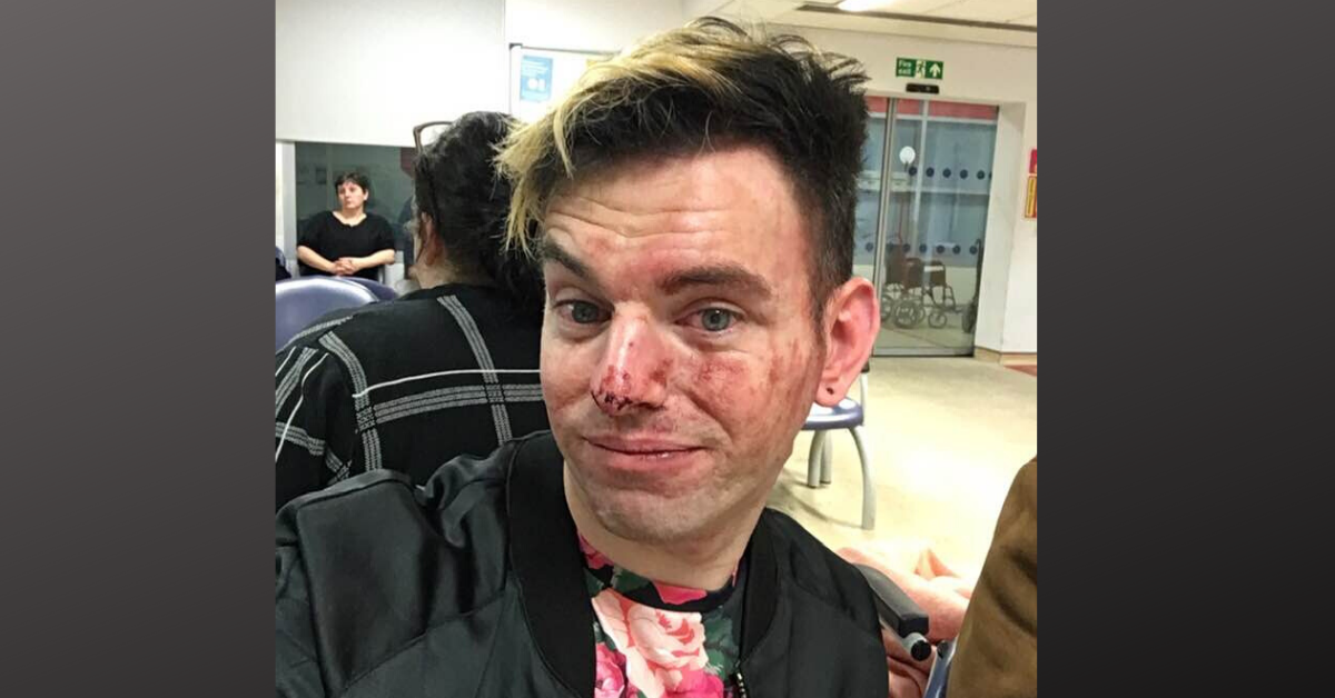 Man Hospitalized After Stepping In To Defend His Two Gay Friends From 'Disgusting' Homophobic Attack