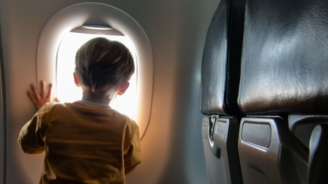 Woman Snaps At Dad On Flight After He Asks Her To Cover Up Her Facial Scar Because It's Scaring His 4-Year-Old Son