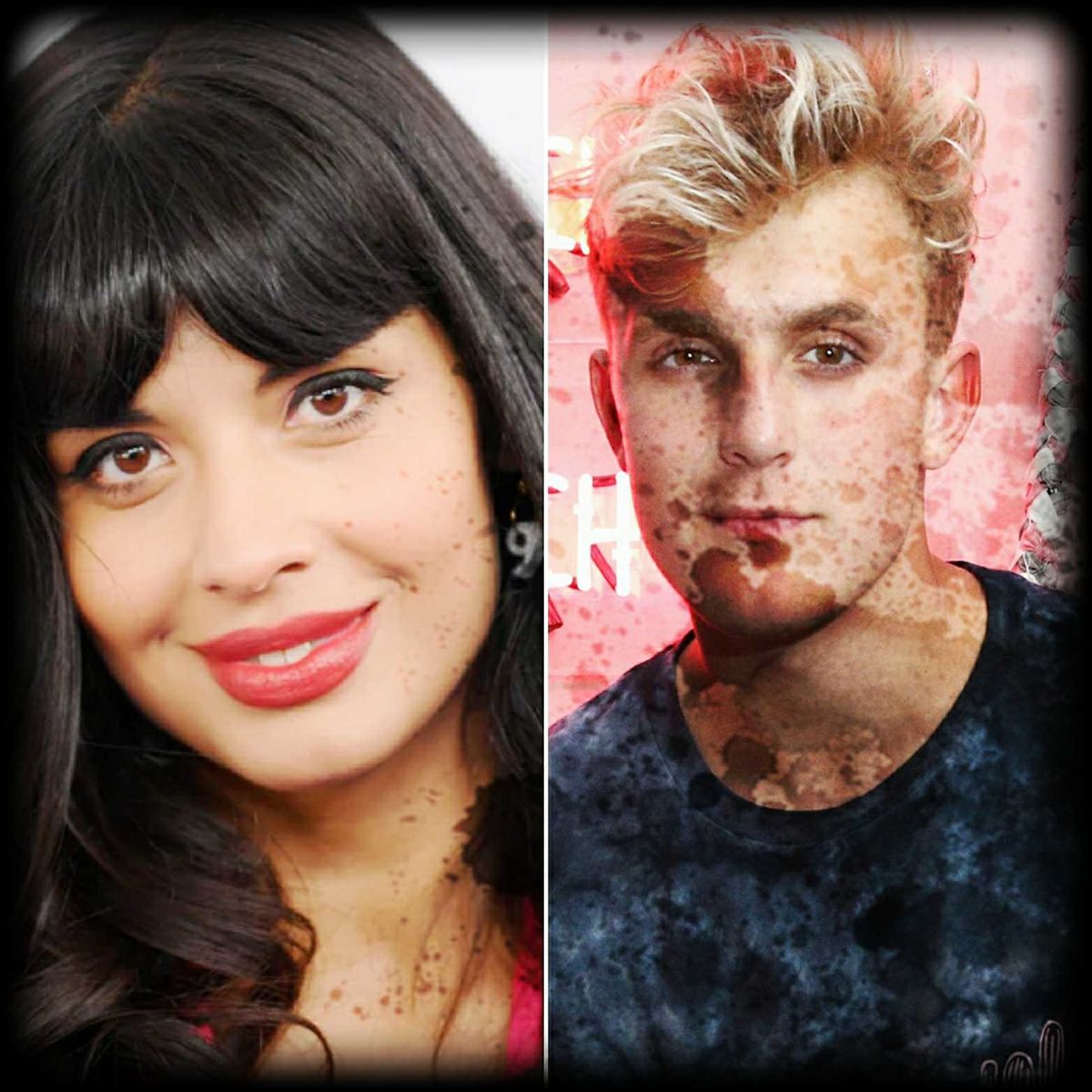 Invisible Illness In Pop Culture What Do Jameela Jamil And Jake Paul 