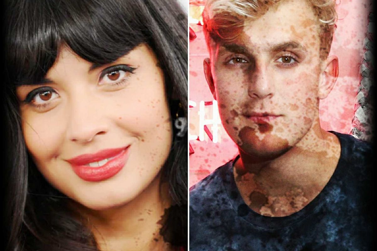 Invisible Illness in Pop Culture: What Do Jameela Jamil and Jake Paul Have in Common?