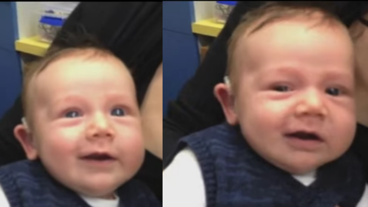 Baby Gets Fitted For His Very First Hearing Device, And His Precious Reaction Is Lighting Up The Internet