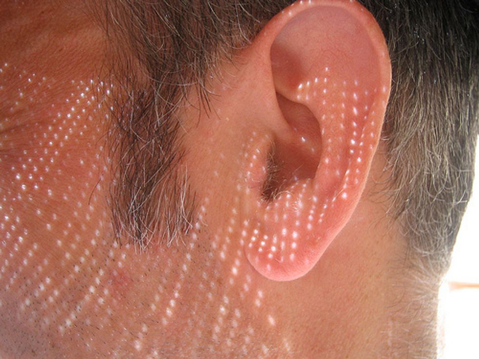 Hear Me Now? Gene Therapy Improves ‘Bionic Ear’ Technology