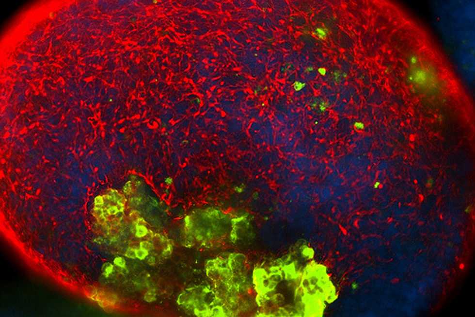 Heart Muscle Successfully Regenerated In Monkeys From Stem Cells