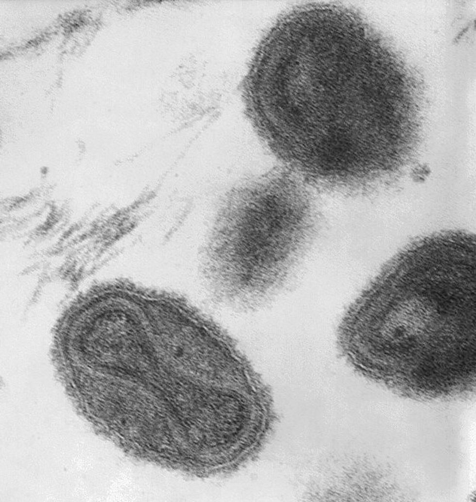 Smallpox Discovered In Old Storage Room Near D.C.