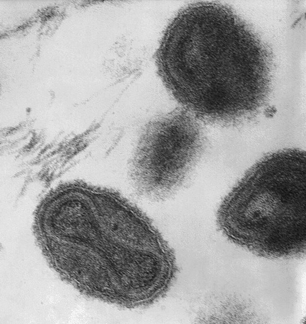 Smallpox Discovered In Old Storage Room Near D.C.