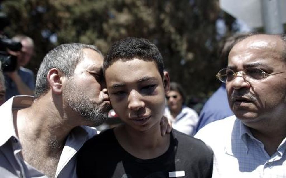American Teen Beaten In Mideast Is A Cousin Of Slain Palestinian