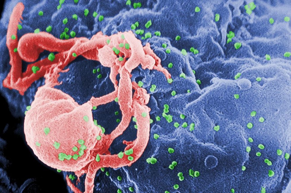 HIV Establishes Viral Reservoirs With Surprising Speed