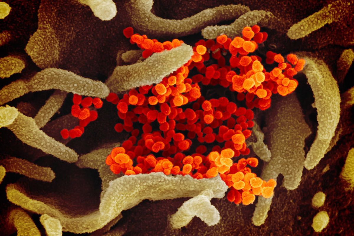 How Bad Was Feds' Initial Response To Coronavirus, On A Scale Of One To 'Let's Not Test Anybody Ever'?