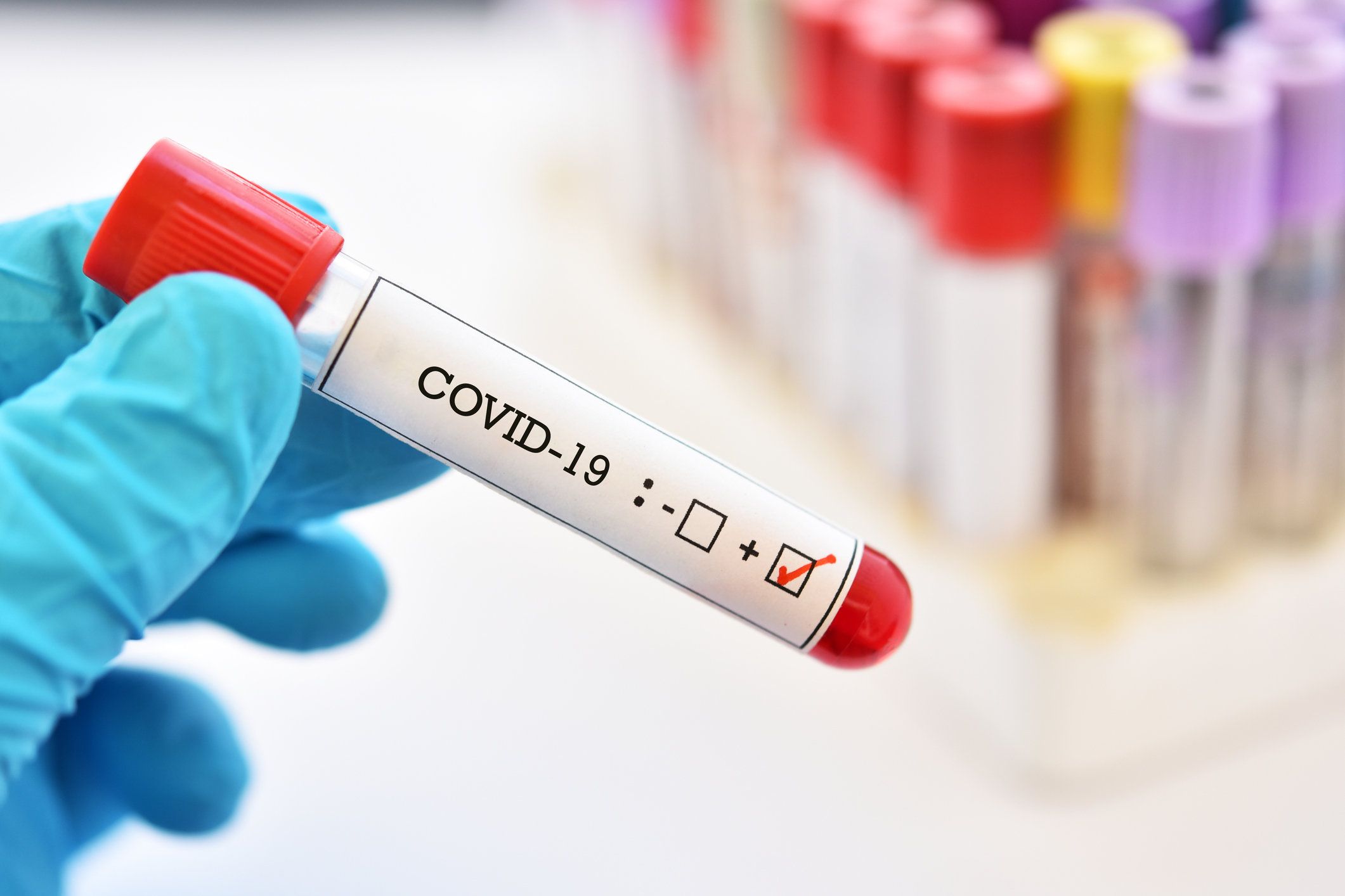 Ormai tutti gli esperti concordano: virus portato in Italia dai tedeschi