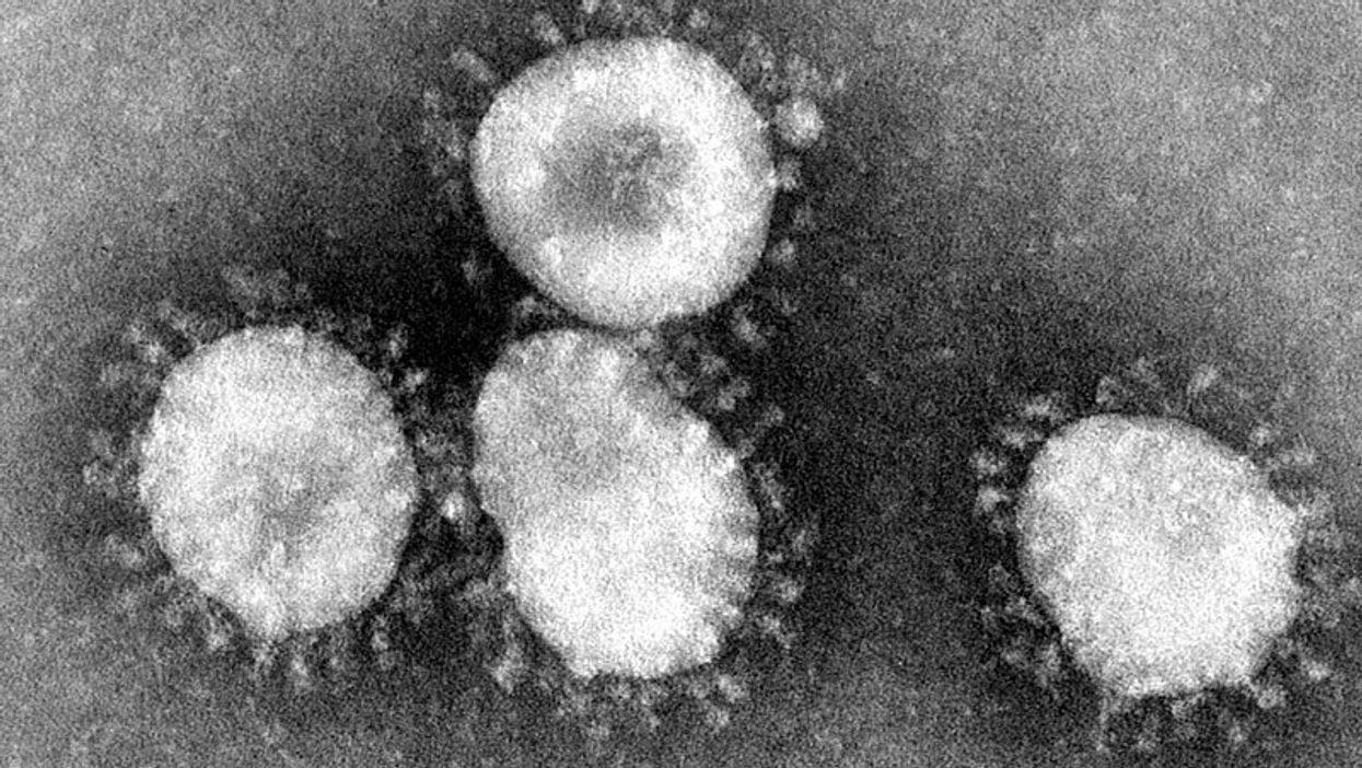 People Explain How The Coronavirus Has Impacted Their Job