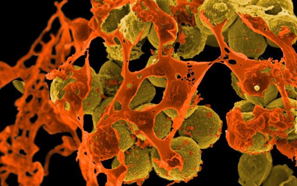 ‘Superbug’ Outbreak Sparks Changes At Hospitals