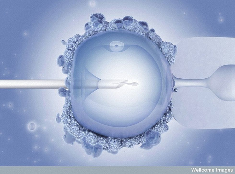 If Abortion Foes Were Really ‘Pro-Life,’ They’d Go After Fertility Clinics Too