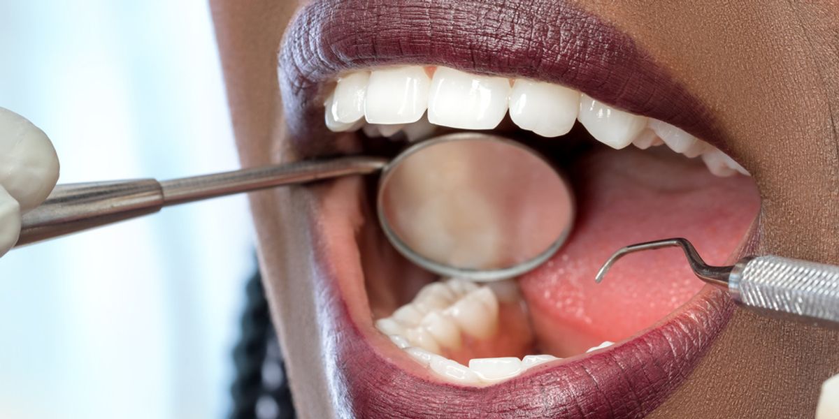 9 Semi-Subtle Signs You Need To See Your Dentist SOON