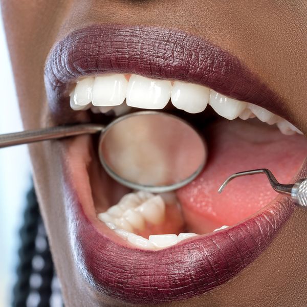 9 Semi-Subtle Signs You Need To See Your Dentist SOON