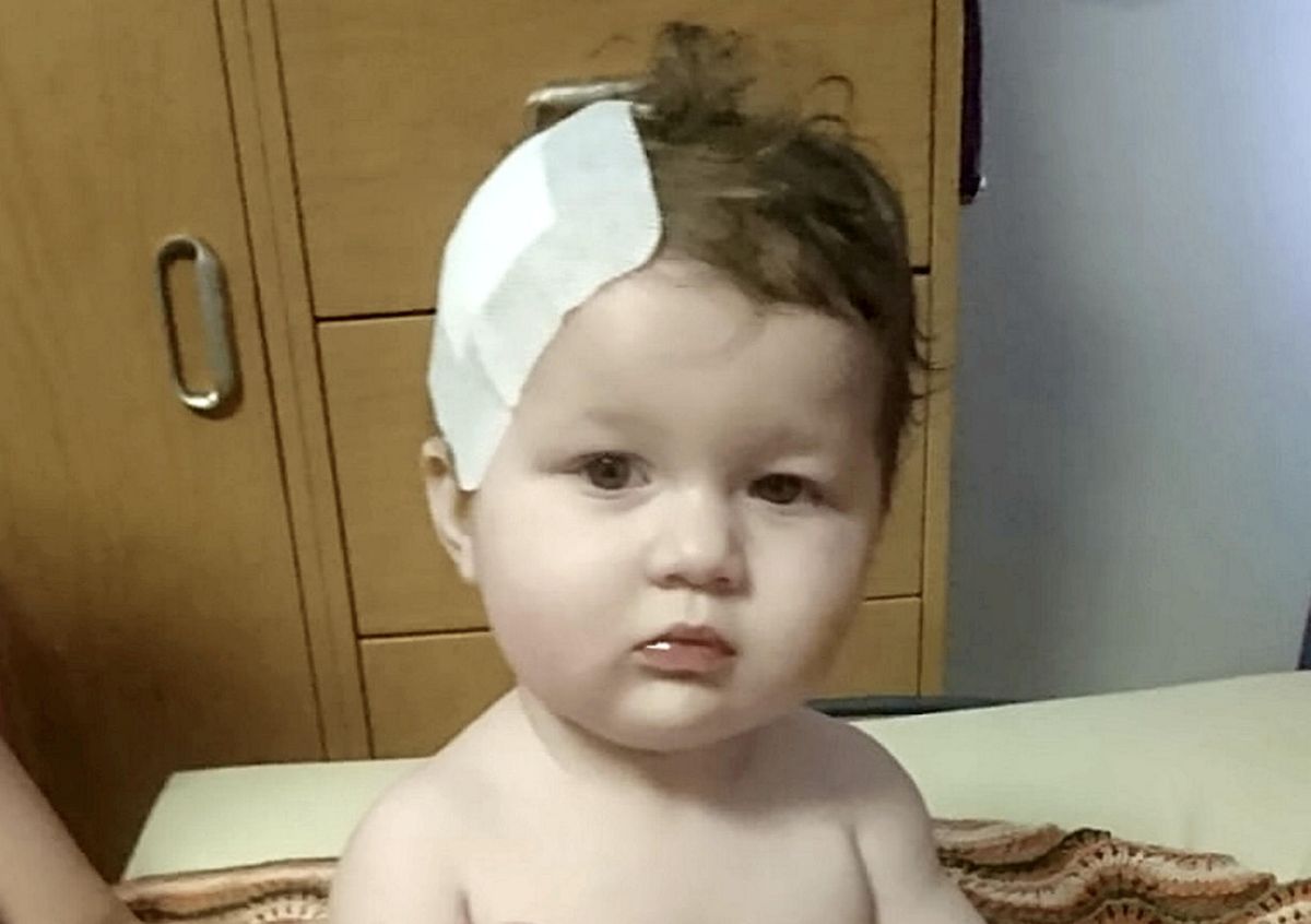 Baby Girl Has Life-Saving Surgery To Remove Aggressive Cancerous Brain Tumor After Being Dismissed As Having A Viral Infection By Eight Different Doctors