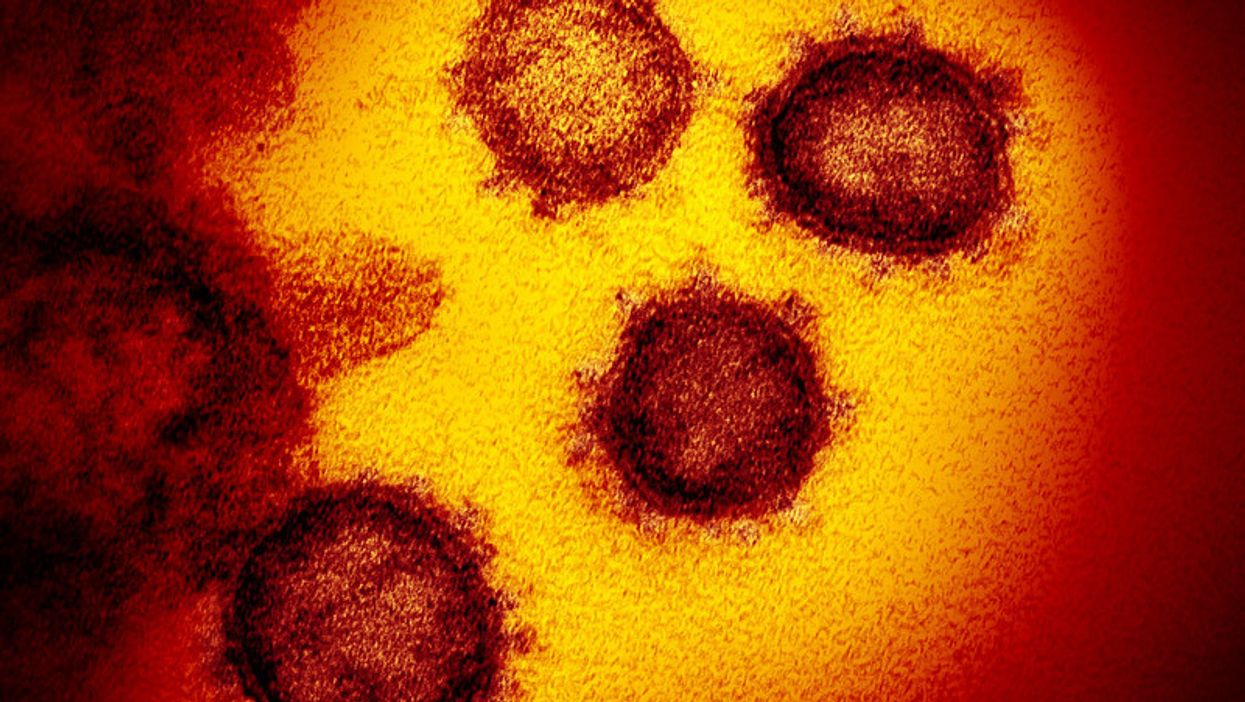 coronavirus, viral orange blob