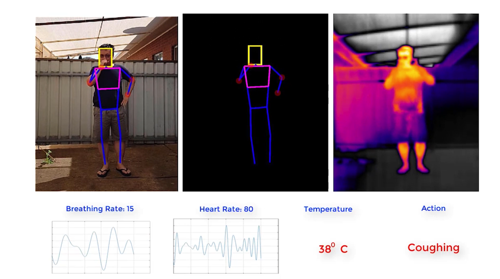 Sensor readings from Vital Intelligence Project