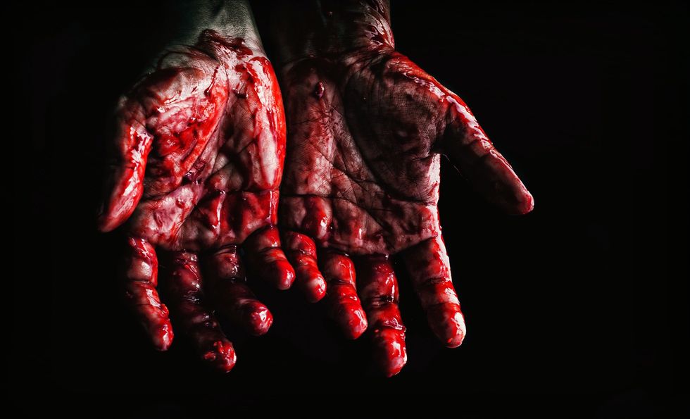 https://www.pexels.com/photo/person-s-hands-covered-with-blood-673862/