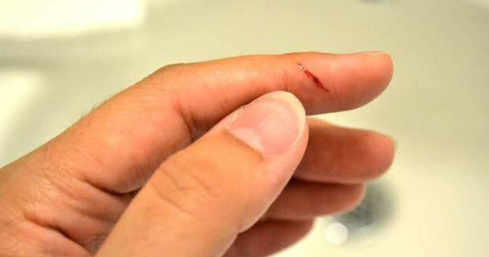 A doctor finally explains the ageold question Why do paper cuts hurt so much? LaptrinhX / News