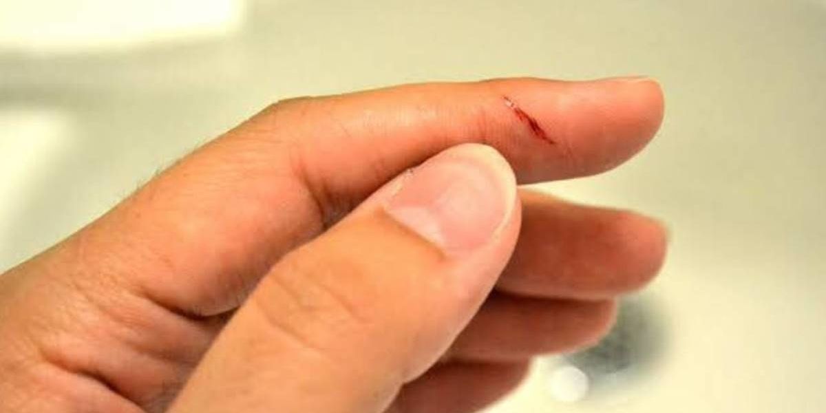 A doctor finally explains the age-old question: Why do paper cuts hurt so  much? - Upworthy