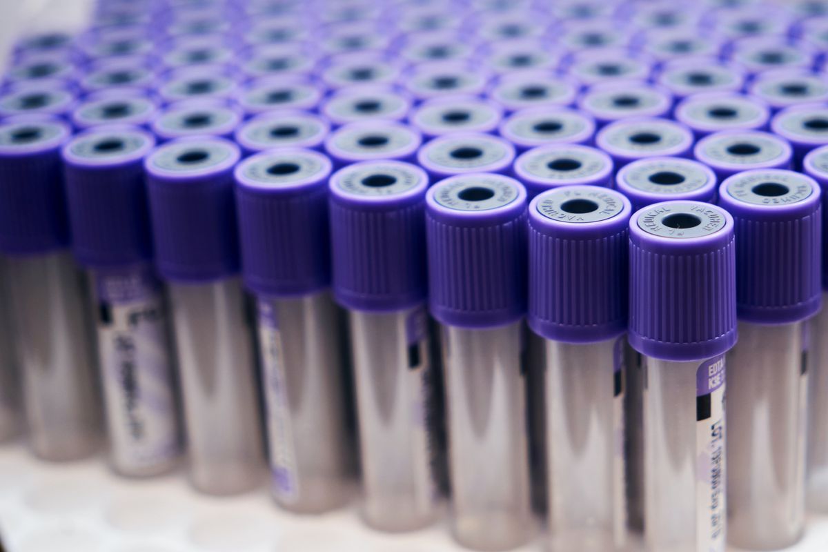 test tube covid 19 coronavirus everlywell